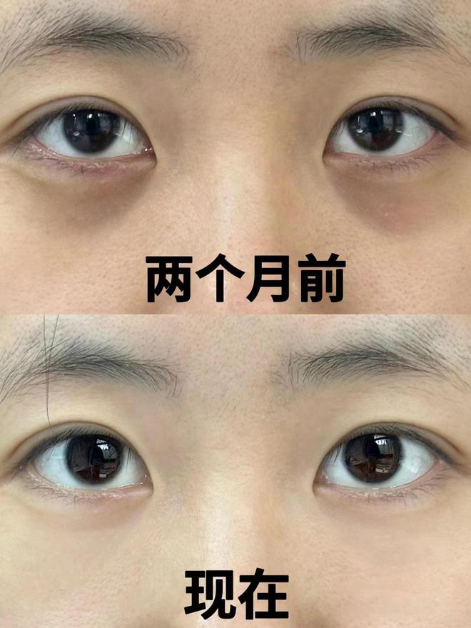 眼霜哪个牌子抗皱去皱效果最好？热门新品抗皱眼霜排行榜分享(图3)